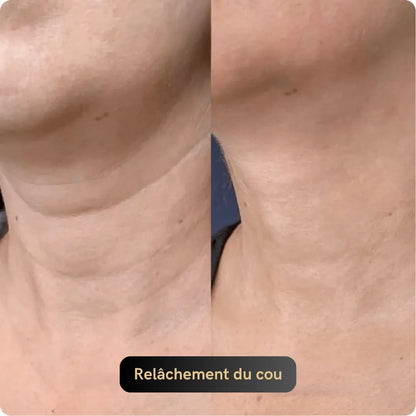 Vitagen® Système Micro-Infusion