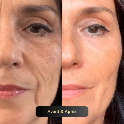 Vitagen® Système Micro-Infusion